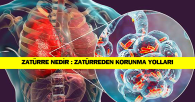 zaturre-nedir-zaturreden-korunma-yollari