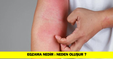 egzama-nedir-egzama-neden-ortaya-cikar